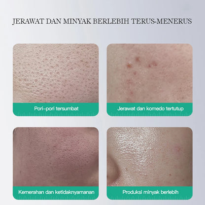 Nettoyant exfoliant pour le visage à l'acide salicylique