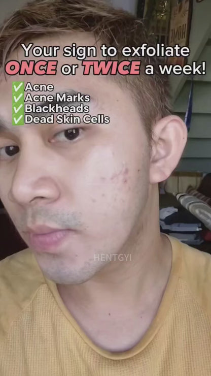 Gel exfoliant Orange et  gommage pour le visage et le corps contre les tâches, les points noirs